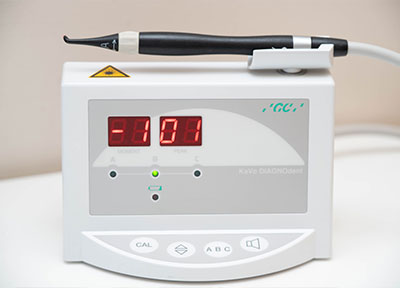 ダイアグノデント